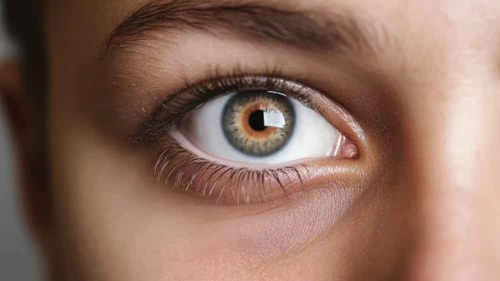 سیاهی دور چشم و ارتباط آن با کمبود ویتامین‌ها